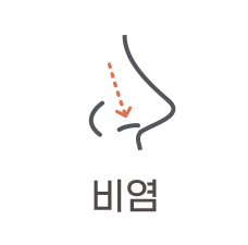 비염