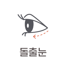 돌출눈