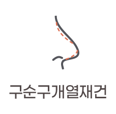 구순구개열재건