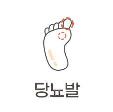 당뇨발